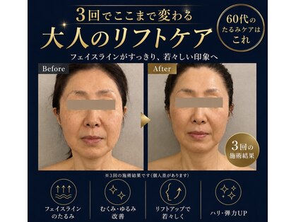 アリィ(Alii)の写真