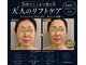 アリィ(Alii)の写真