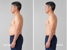 ミネルバ(MINERVA)/【施術例】　50代男性　痩身