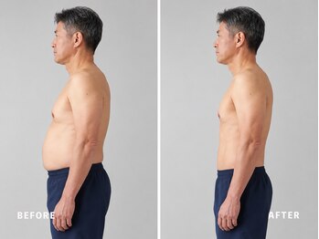 ミネルバ(MINERVA)/【施術例】 50代男性 痩身