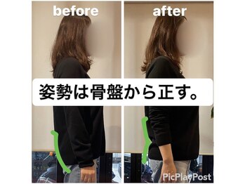 カワル整体 上通り院/【姿勢は骨盤から正す】