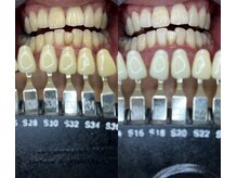 トウキョウスワーズ 池袋店(TOKYO SWRS)/#ホワイトニング #池袋 #渋谷