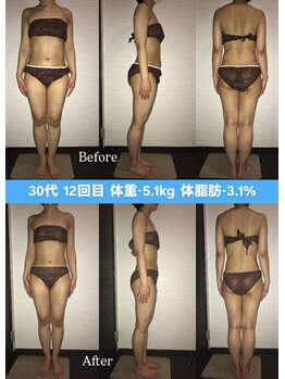 シェイプ 浜松本店/褒められボディーはシェイプで