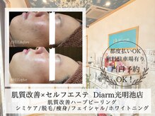 ディアーム 光明池店(Diarm)