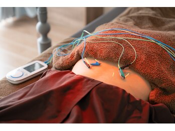 キヅキ鍼灸整体スタジオ(KIZUKI鍼灸整体スタジオ)/辛い腰には、はり×電気