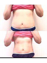 ビューティセレクト ビ プル(Be ple)/キレイになりましょう♪