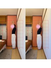 ヴィアス(Vias)/辛い肩こりにシナプス療法