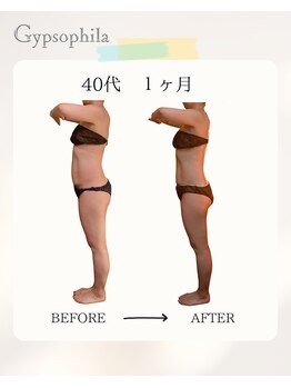 ジプソフィラ(Gypsophila)/痩身ビフォーアフター