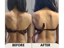 プラスイー(+e)/施術１回！