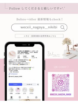 ウェクシー 名古屋駅前店(WECXII)/Instagram ニキビ・肌質改善
