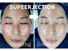 トータルビューティーサロンリア(Li'a)