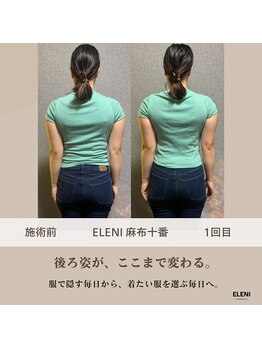エレーニ 麻布十番(ELENI)/自分の後ろ姿を、好きになれる。
