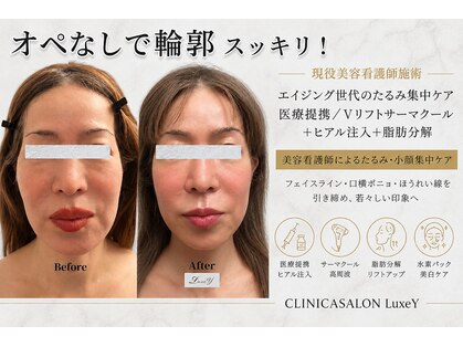 リュクシー(LuxeY)の写真