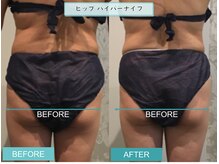 プライマルビューティ 艶 本店(Primal Beauty)/本気の痩身！ADEで痩せよう！