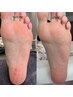 【足裏ふんわり...】足裏美人角質フットケア