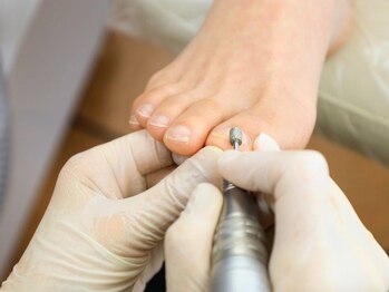 施術【4．マシンケア】