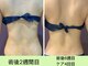 インディバ ミマリ(INDIBA ミマリ)の写真