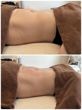 ワッカ(wacca)/YOLO式腸もみ