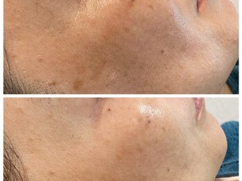 アンサリカ(ansalika)/ザラつきごわつきにも効果あり★