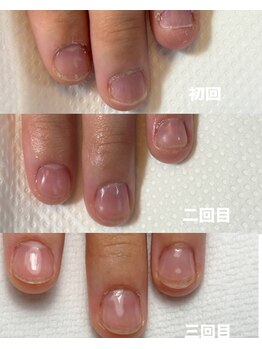 ハンド ケイ(Hand K)/自爪育成