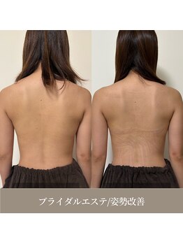 天使の艶肌 武蔵小杉店/ブライダルエステ姿勢改善