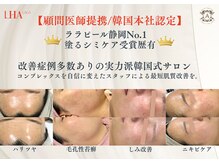 アウラプラス(Aura+)