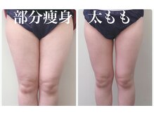 リリアーナ(LILIANA)の雰囲気（サイズダウン/太もも/お腹/浮き輪肉/部分スリム/ブライダル）