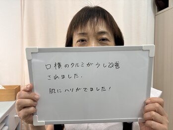 たるみアガル(たるみagaru)/大山でたるみ改善 変化実感の声