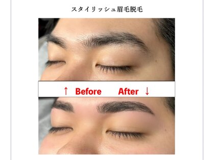 リムーヴ(Re:move)の写真