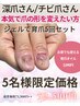 【美爪育成】深爪/チビ爪/かみ癖等で自分の爪がボロボロの方へ★お悩み解決