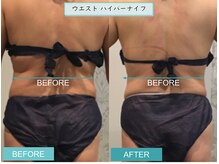 プライマルビューティ 艶 本店(Primal Beauty)/本気の痩身！ADEで痩せよう！