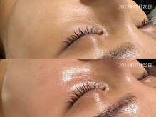 レイル(REIR)/メニュー：純粋レチノールピール