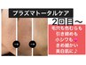 【プラズマトータルケア】2回目以降★30%off美白毛穴リフトUPも♪幹細胞無料