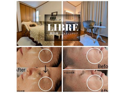 エステサロン リブル(LIBRE)の写真