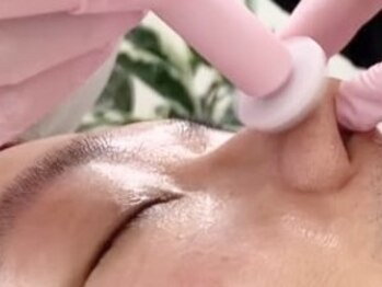 モテ美白の写真/プロセルセラピーズで史上最強の毛穴シワ改善【全国最安値¥35,000】