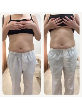 ジョワイユ(Joyeux)/腸の位置でお腹は変わる