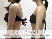ミヨンラボ(miyon LABO)/ハイパーナイフ 6回