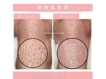 モテ 新宿店(Mote)