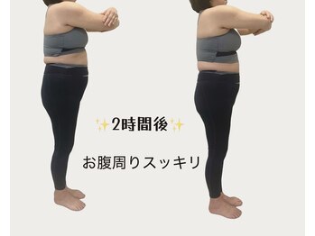 マフォン(mafon)/ビフォーアフター/西新井