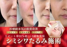 ハナ チュチュ(Hana chuchu)