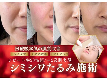 ハナ チュチュ(Hana chuchu)の写真