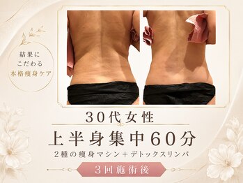 ビューティスト(Beautist)/【３０代女性】上半身集中６０分