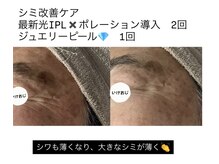 ル ボヌール/最新IPL　シミ改善
