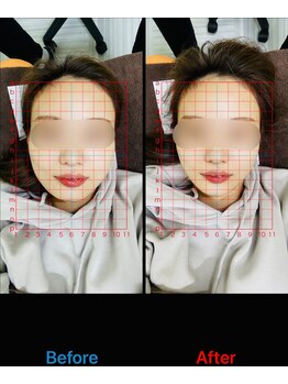 大久保ひまわり整骨院の写真/【お顔の歪み改善に自信あり】歪みを整えて最高のフェイスラインに導きます♪小顔・たるみにお悩みの方へ◎