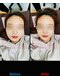 大久保ひまわり整骨院の写真/【お顔の歪み改善に自信あり】歪みを整えて最高のフェイスラインに導きます♪小顔・たるみにお悩みの方へ◎