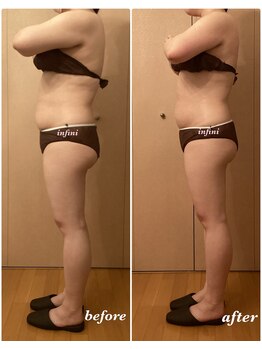 アンフィニ(infini)/全身短期集中コース5回(2ヶ月)