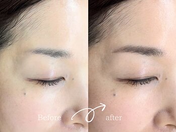 レディゴー(LADY GO)/美肌＆美眉