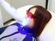 ホワイトニングショップ 山口店の写真/【学割あり◎】他店で効果を実感できなかった方にも☆セルフホワイトニングで理想の白く美しい歯に♪