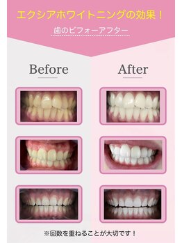 エクシアホワイト 山形西バイパス店/ビフォーアフター