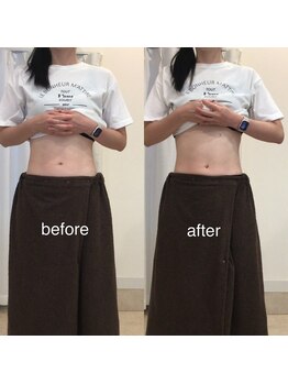 ジョワイユ(Joyeux)/腸の位置でお腹は変わる